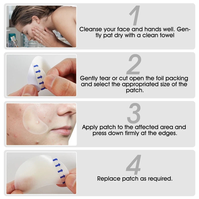 20 Acne Pimple Patches