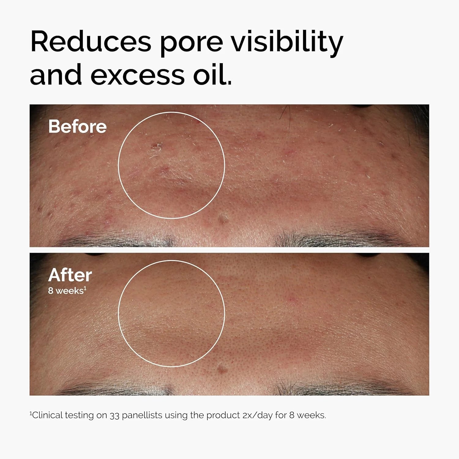 30ml of 10% Niacinamide+1% Zinc