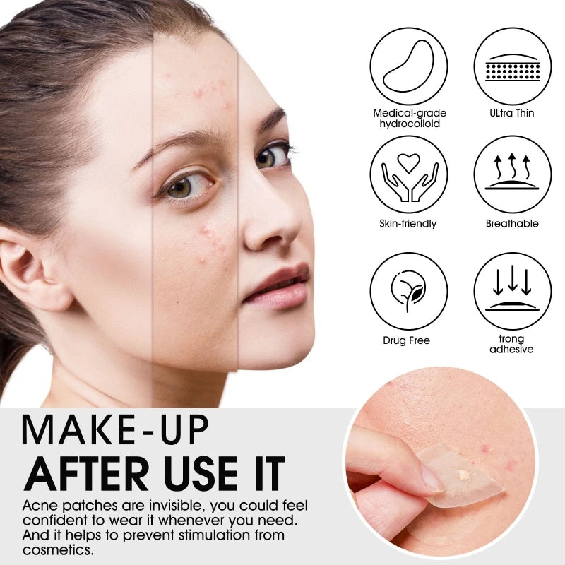 20 Acne Pimple Patches